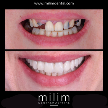 Slider image (8) Milim Dental